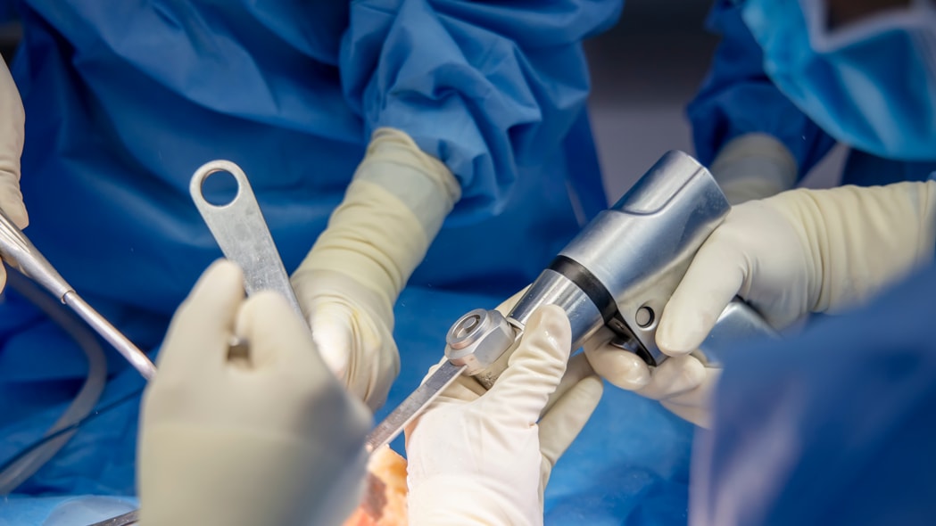 a close-up of hands in gloves holding a metal object