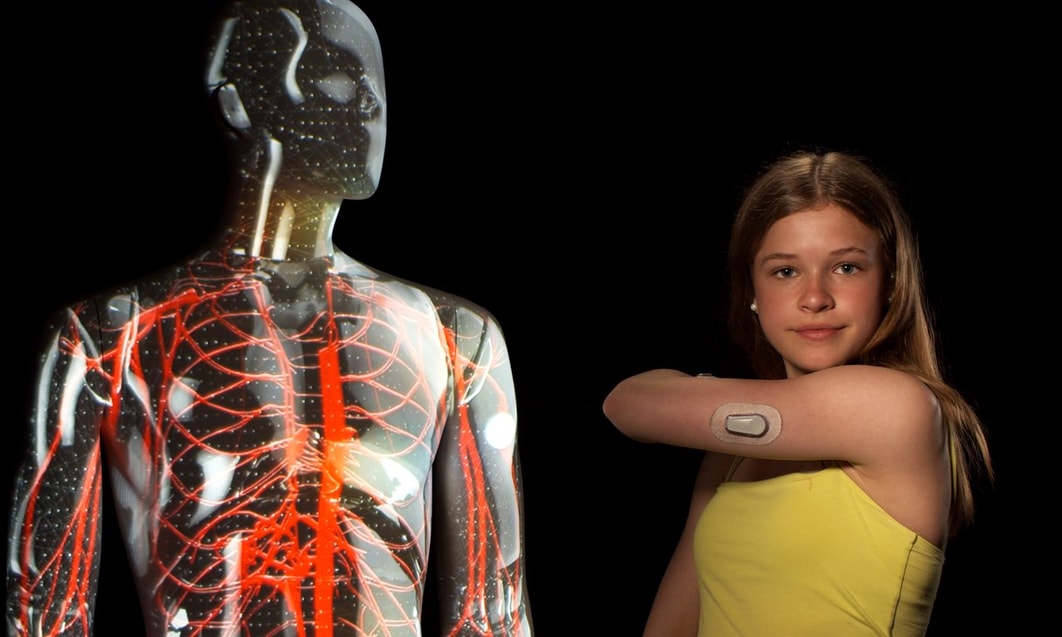 a person with a medical device on her arm
